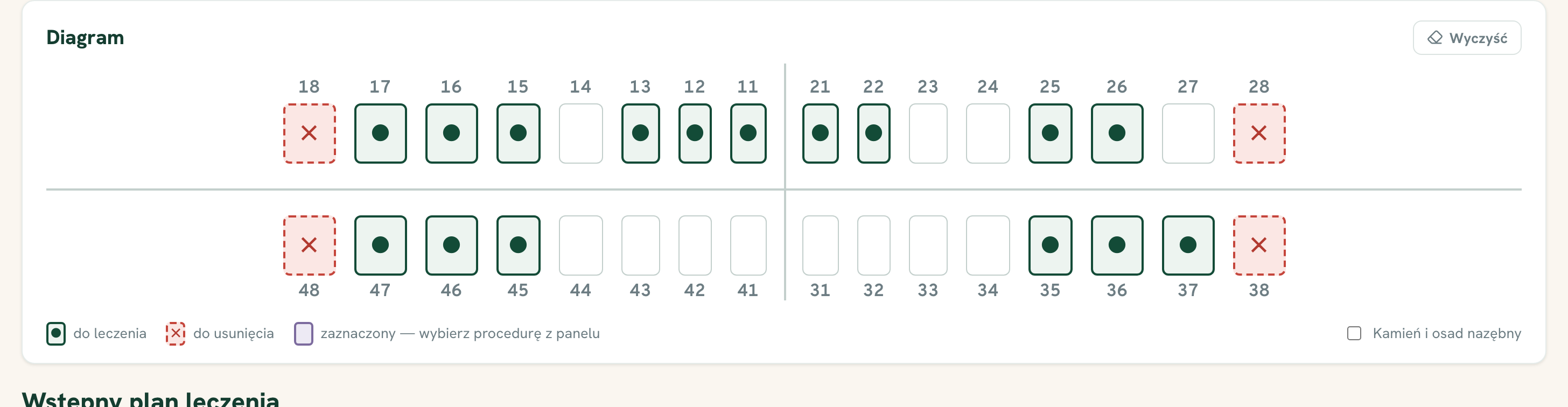 Diagram zębów w notacji FDI: zęby do leczenia i do usunięcia.